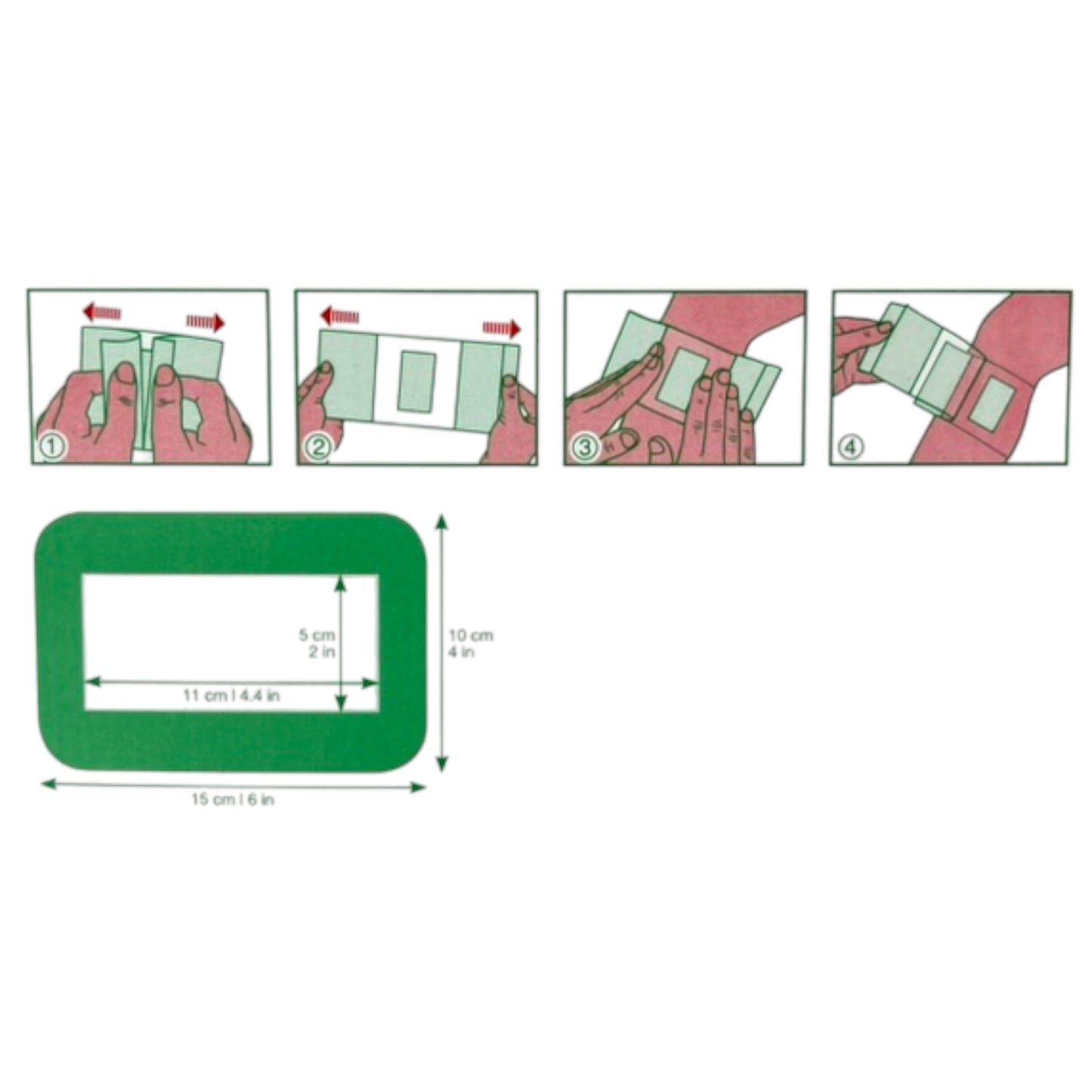 Lohmann & Rauscher Curapor transparent Wundverband steril, 10x15cm, 25 Stück